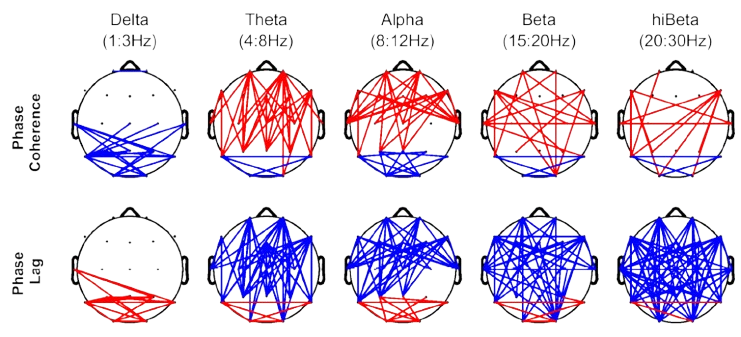 qEEG connectivity visualisation