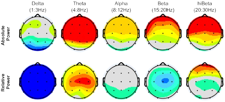 qEEG spectral power visualisation